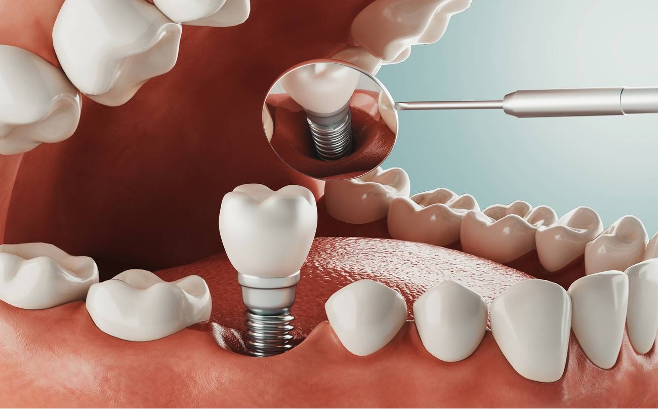 Dental Services